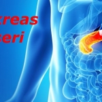 Pankreas Kanseri