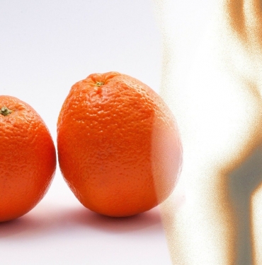 Selülit İçin Ne Yapılmalı