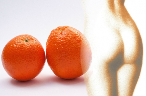 Selülit İçin Ne Yapılmalı