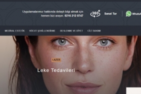 Cilt Lekelerini Temizleme Yöntemleri