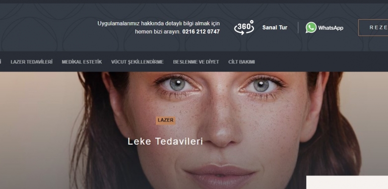 Cilt Lekelerini Temizleme Yöntemleri