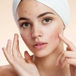 Clindoxyl Jel Ne İşe Yarar?