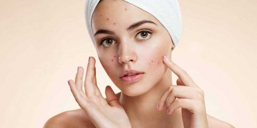 Clindoxyl Jel Ne İşe Yarar?