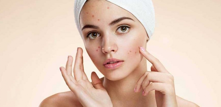 Clindoxyl Jel Ne İşe Yarar?