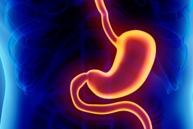 Mide bozulmasına ne iyi gelir?