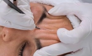 Kolajen İp Protokolu