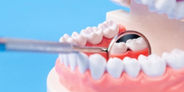 Protez Diş Çözümleri