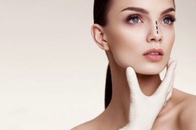 Burun Estetiği Sonrası