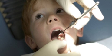 Diş Çürüğü Tedavisi