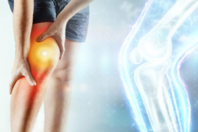 Diz Kireçlenmesi Ameliyatı