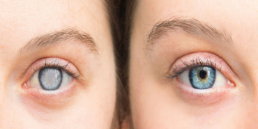 Katarakt ameliyatı sonrası