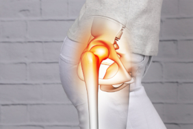 Kalça Kireçlenmesi Ameliyatı