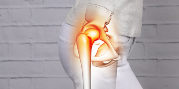 Kalça Kireçlenmesi Ameliyatı