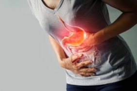 Reflü Hastalığı Nedir?