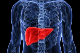 Karaciğer Yağlanması