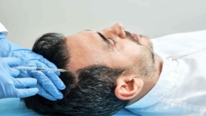 Kök hücreli saç ekimi