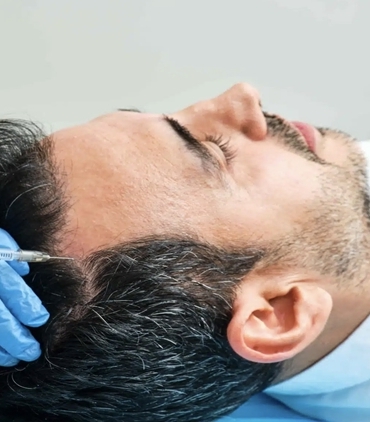 Kök hücreli saç ekimi