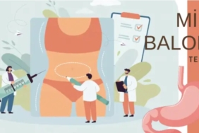 Mide Balonu Nedir?