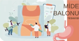 Mide Balonu Nedir?