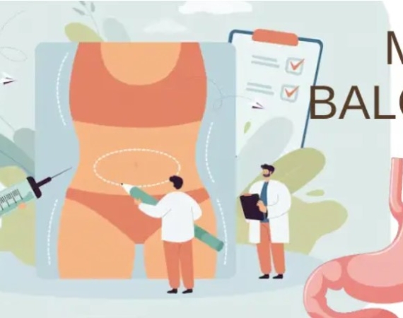 Mide Balonu Nedir?