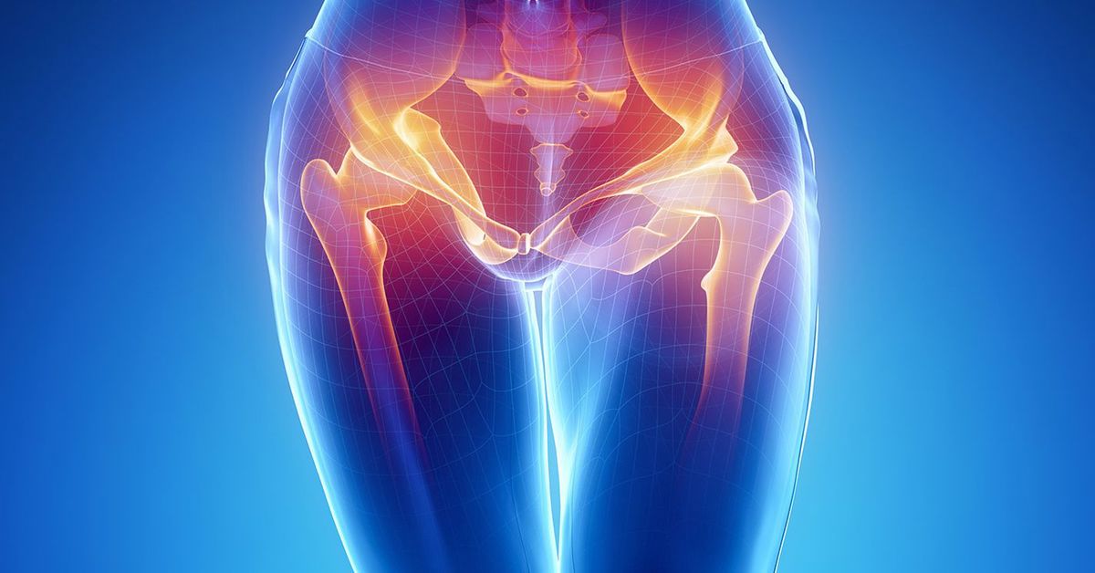 Kalça Kireçlenmesi Ameliyatı Sonrası Süreç Nasıldır?