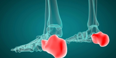 Sever Hastalığı Nedir?