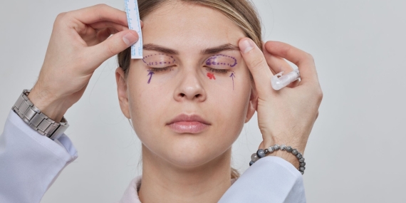 Blefaroplasti Nedir?